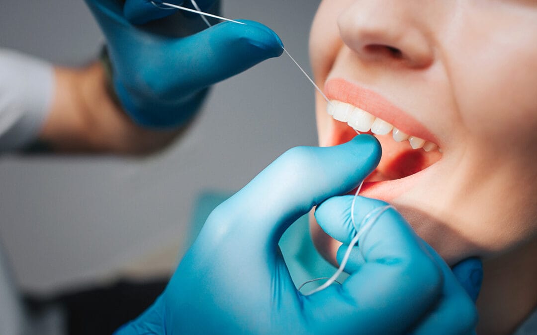 What to Expect During a Dental Cleaning?