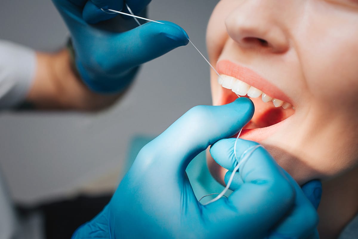 What to Expect During a Dental Cleaning?