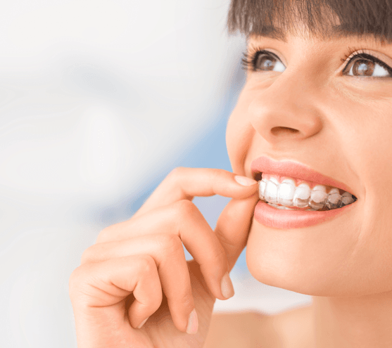 Invisalign Clear braces