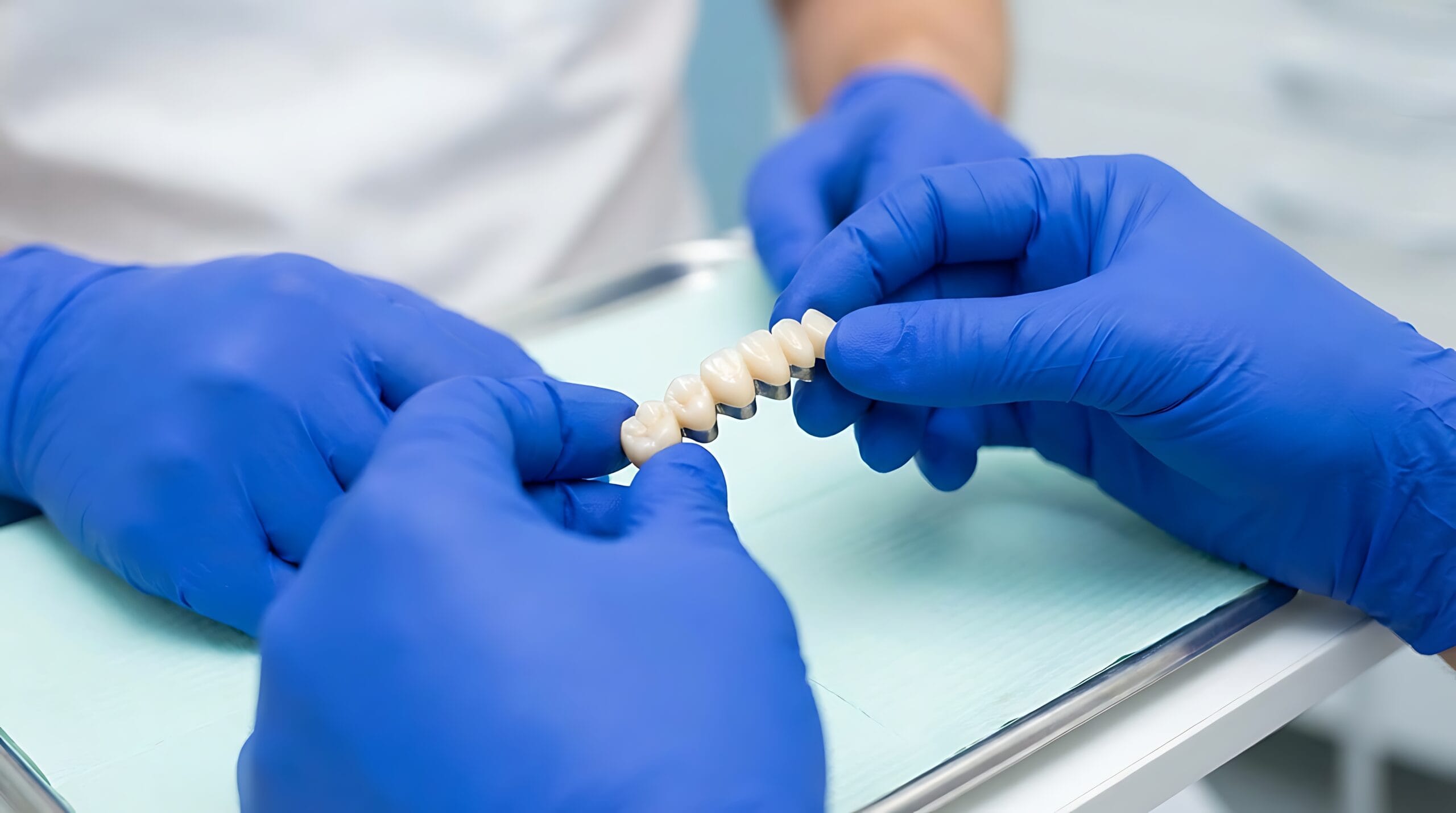 Restorations (Fillings)