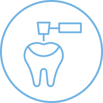 Dental Fillings Ottawa