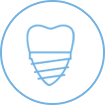 Restoration and dental implants ottawa