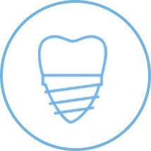 Restoration and dental implants ottawa