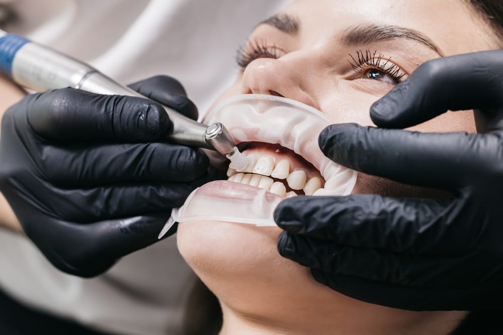 Why Regular Dental Cleanings Matter More After Winter?